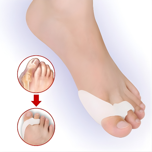 Set Silikonskih Štitnika -Za Stopala Bez Bola🦶🦶